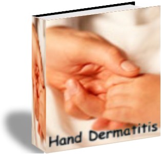 Hand Dermatitis