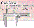 Cardio Calipers